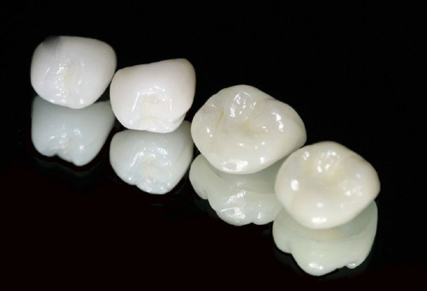 Răng Toàn Sứ Zirconia Và Lava Plus